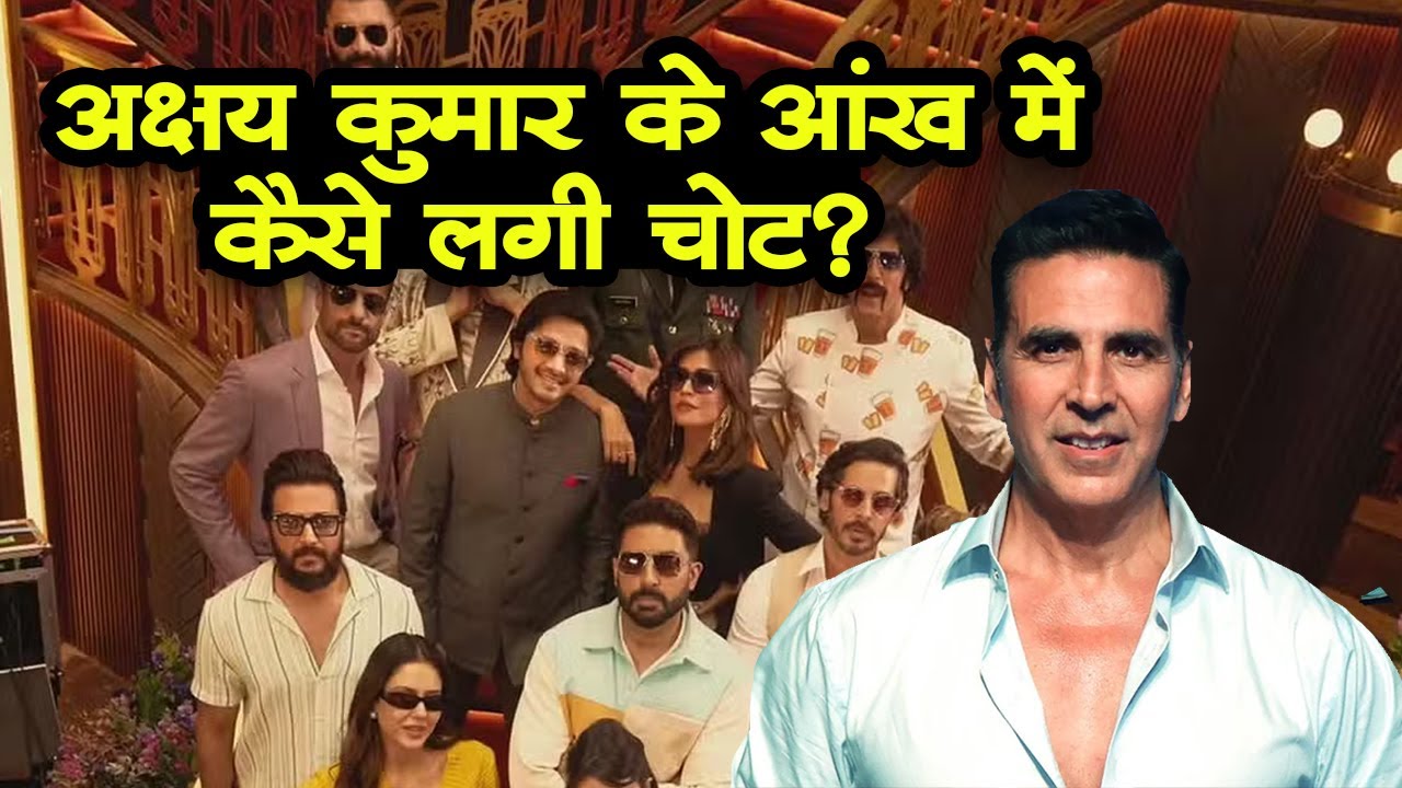 Housefull 5 की शूटिंग के दौरान हादसे का शिकार हुए Akshay Kumar, आंख में लगी चोट